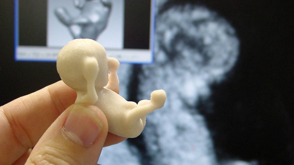 Foetus