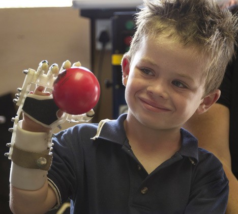 Robohand_3a
