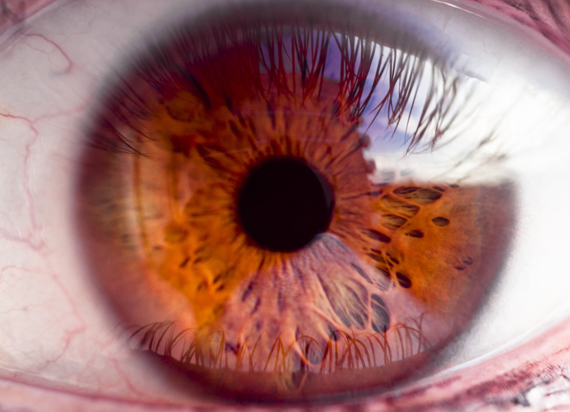 oog